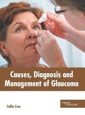 Causes, Diagnosis and Management of Glaucoma - 