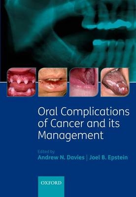 Oral Complications of Cancer and its Management - 