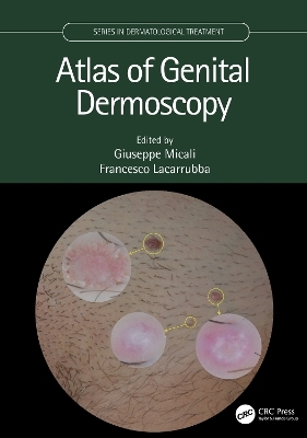 Atlas of Genital Dermoscopy - 