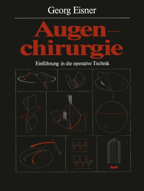 Augenchirurgie - Georg Eisner