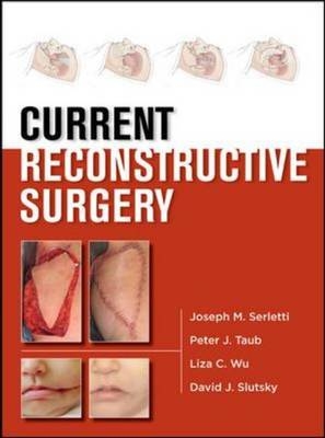 Current Reconstructive Surgery -  Joseph M. Serletti,  David Slutsky,  Peter J. Taub,  Liza Wu