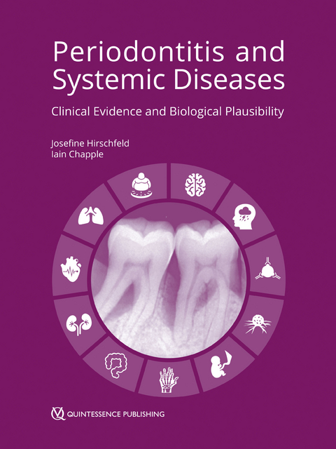 Periodontitis and System Diseases - Josephine Hirschfeld