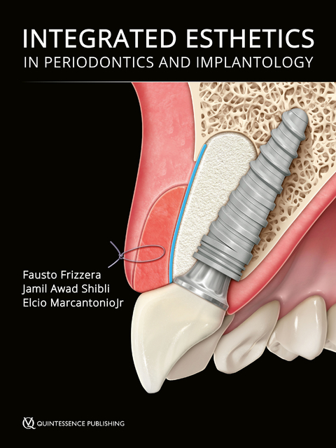 Integrated Esthetics in Periodontics and Implantology - 