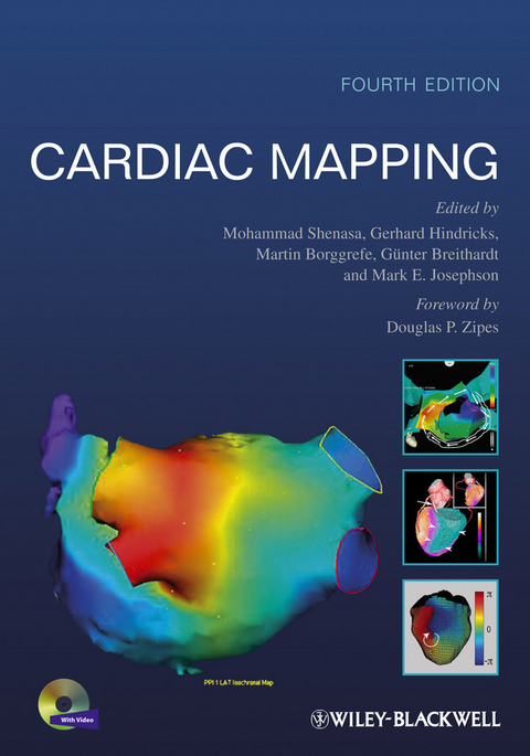 Cardiac Mapping - 