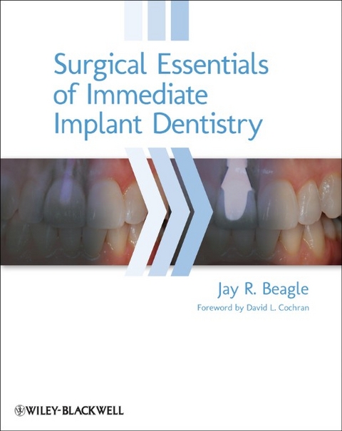 Surgical Essentials of Immediate Implant Dentistry - Jay R. Beagle