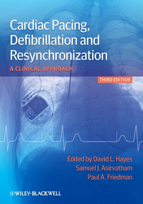 Cardiac Pacing, Defibrillation and Resynchronization - 