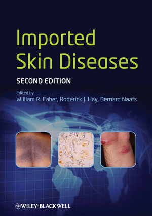 Imported Skin Diseases - 