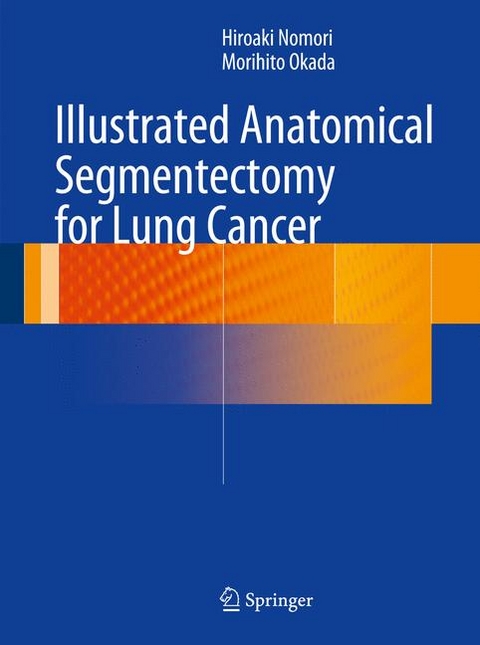 Illustrated Anatomical Segmentectomy for Lung Cancer - Hiroaki Nomori, Morihito Okada