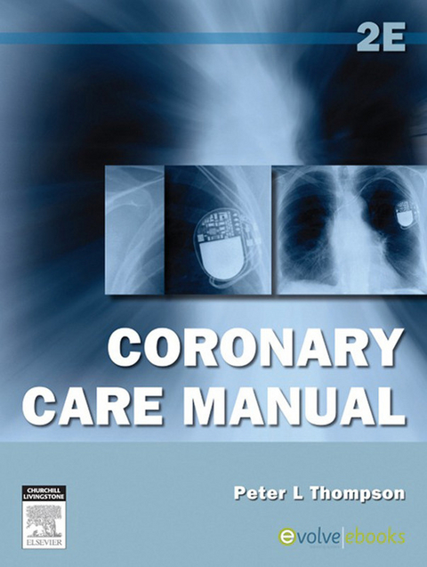 Coronary Care Manual -  Peter L. Thompson