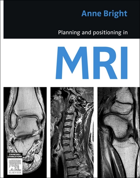 Planning and Positioning in MRI - E-Book -  Anne Bright