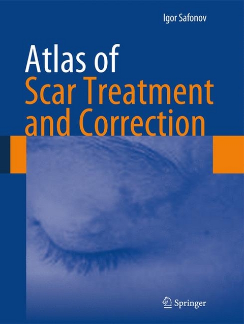 Atlas of Scar Treatment and Correction - Igor Safonov