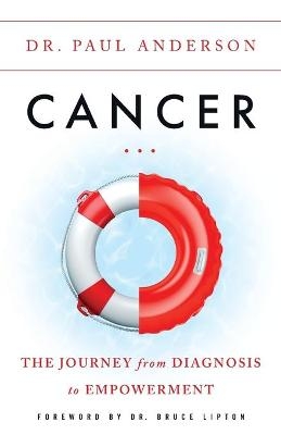 Cancer - Dr Paul Anderson