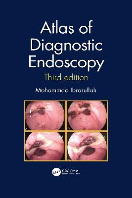 Atlas of Diagnostic Endoscopy, 3E - Mohammad Ibrarullah