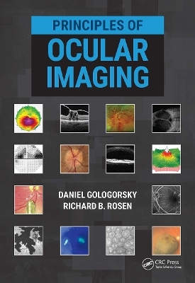 Principles of Ocular Imaging - Daniel Gologorsky, Richard Rosen