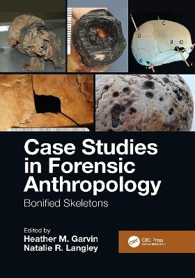 Case Studies in Forensic Anthropology - 