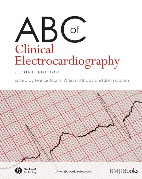 ABC of Clinical Electrocardiography - 