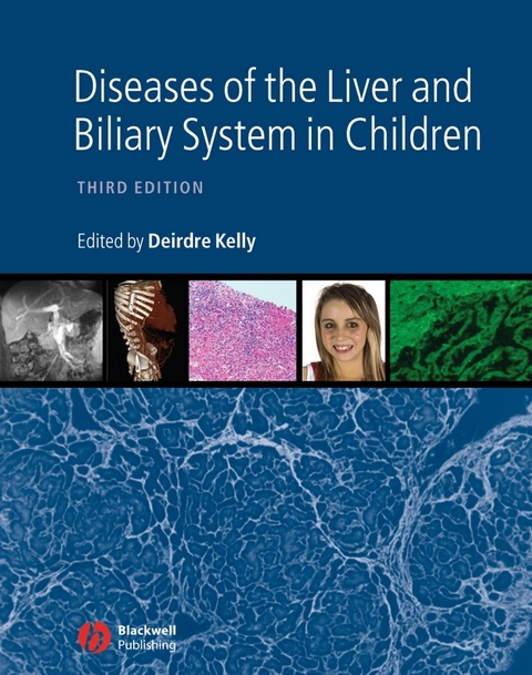 Diseases of the Liver and Biliary System in Children - 