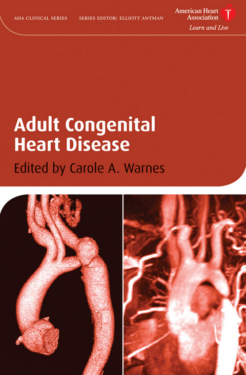 Adult Congenital Heart Disease - 