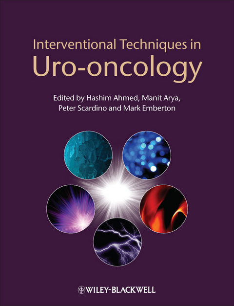 Interventional Techniques in Uro-oncology - 