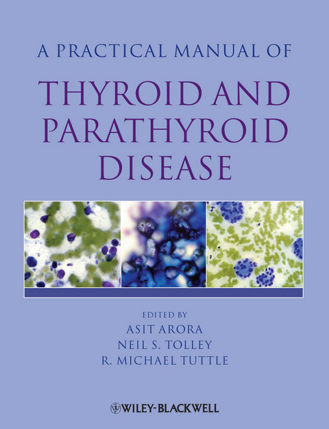 Practical Manual of Thyroid and Parathyroid Disease - 