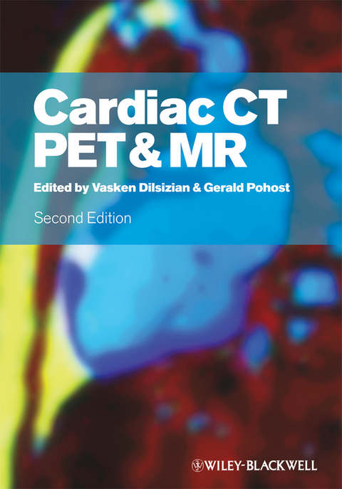 Cardiac CT, PET and MR - 