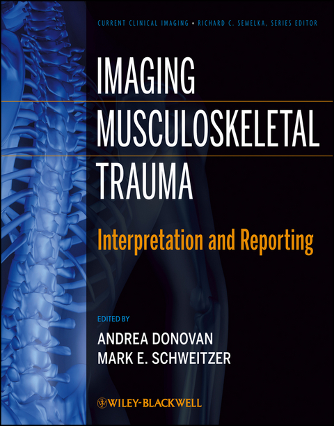 Imaging Musculoskeletal Trauma - 