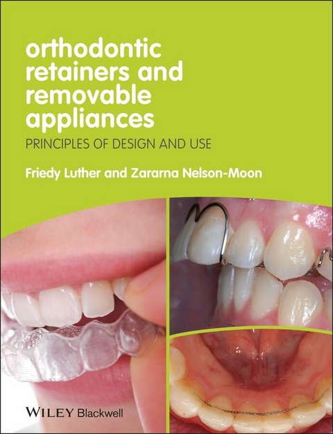 Orthodontic Retainers and Removable Appliances - Friedy Luther, Zararna Nelson-Moon