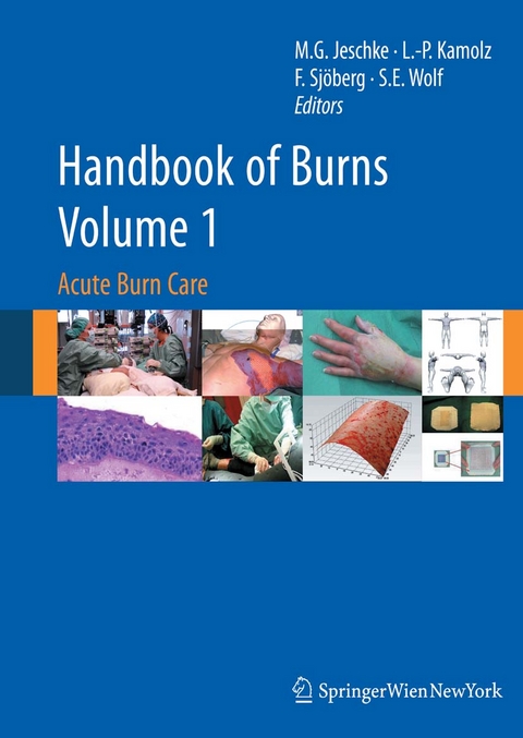 Handbook of Burns Volume 1 - 