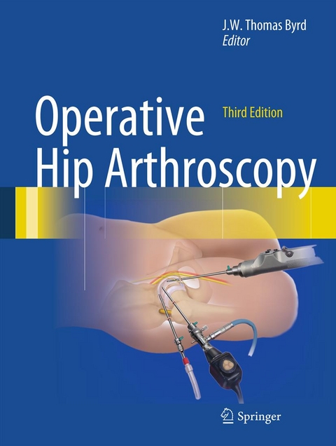 Operative Hip Arthroscopy - 