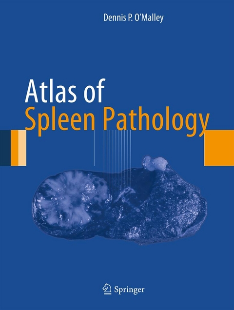 Atlas of Spleen Pathology - Dennis P. O'Malley