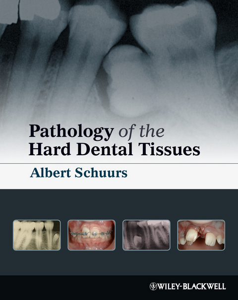 Pathology of the Hard Dental Tissues - Albert Schuurs