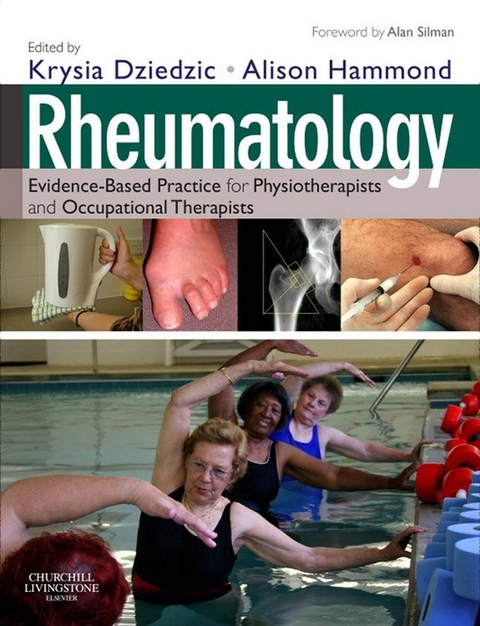 Rheumatology E-Book - 