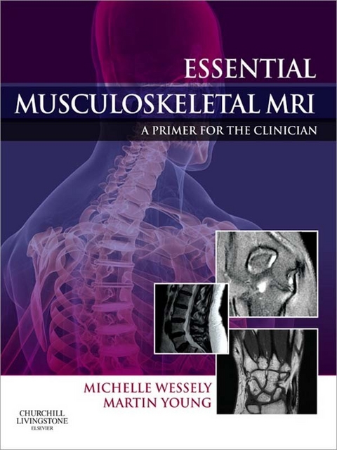 Essential Musculoskeletal MRI -  Michelle Anna Wessely,  Martin Ferrier Young