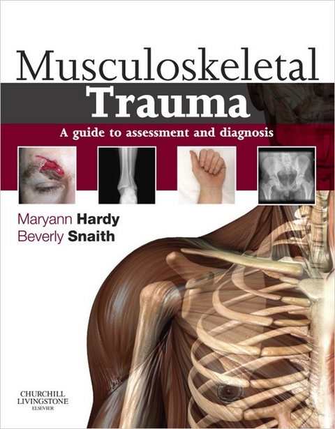 Musculoskeletal Trauma -  Maryann Hardy,  Beverly Snaith