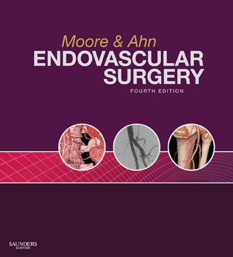 Endovascular Surgery E-Book -  Wesley S. Moore