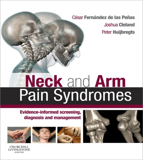 Neck and Arm Pain Syndromes -  César Fernández de las Peñas,  Joshua Cleland,  Peter A. Huijbregts