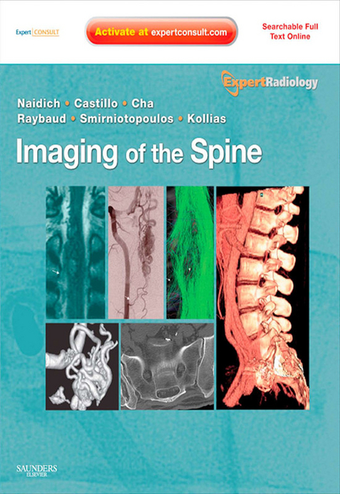 Imaging of the Spine E-Book -  Thomas P. Naidich,  Mauricio Castillo,  Soonmee Cha,  Charles Raybaud,  James G. Smirniotopoulos,  Spyros