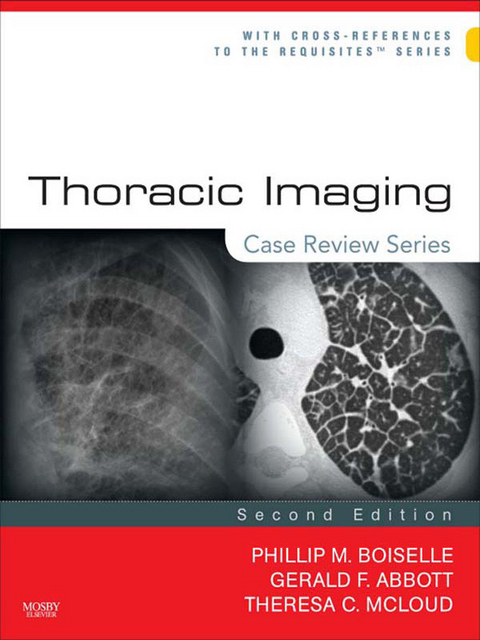 Thoracic Imaging: Case Review Series -  Gerald F. Abbott,  Phillip M. Boiselle,  Theresa C. McLoud