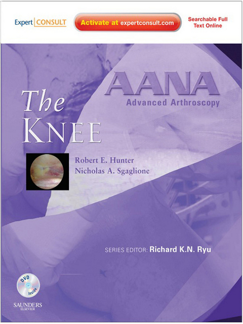 AANA Advanced Arthroscopy: The Knee E-Book -  Robert E. Hunter,  Nicholas A. Sgaglione