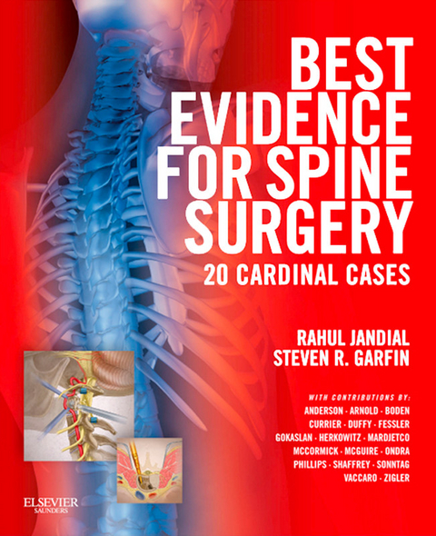 Best Evidence for Spine Surgery E-Book -  Steven R. Garfin,  Rahul Jandial