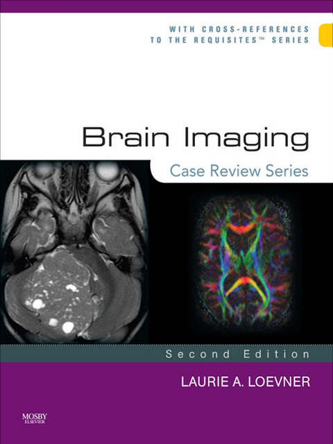 Brain Imaging: Case Review Series E-Book -  Laurie A. Loevner