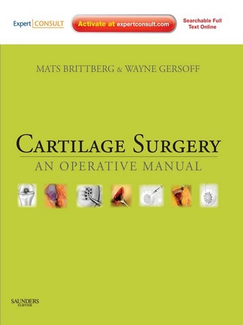 Cartilage Surgery E-Book -  Mats Brittberg,  Wayne Gersoff