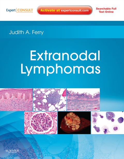 Extranodal Lymphomas E-Book -  Judith A. Ferry