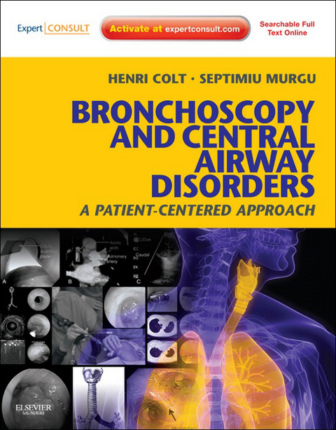 Bronchoscopy and Central Airway Disorders E-Book -  Henri Colt,  Septimiu Murgu