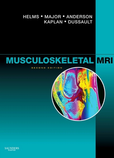 Musculoskeletal MRI E-Book -  Mark W. Anderson,  Robert Dussault,  Clyde A. Helms,  Phoebe Kaplan,  Nancy M. Major