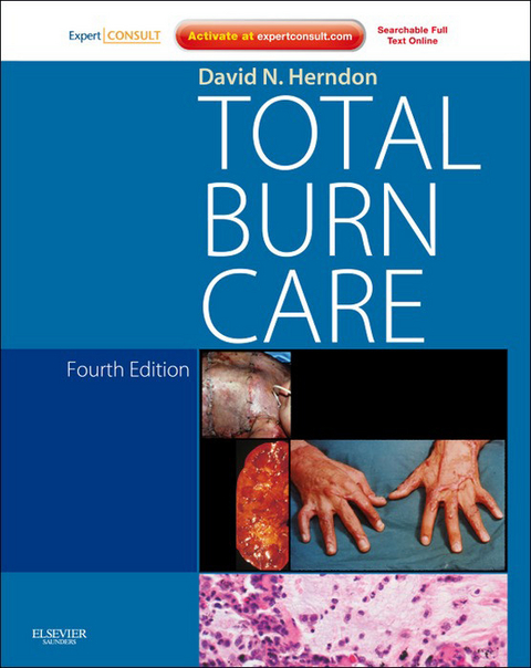 Total Burn Care E-Book -  David N. Herndon