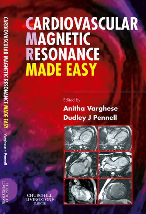 Cardiovascular Magnetic Resonance Made Easy -  Dudley J. Pennell,  Anitha Varghese