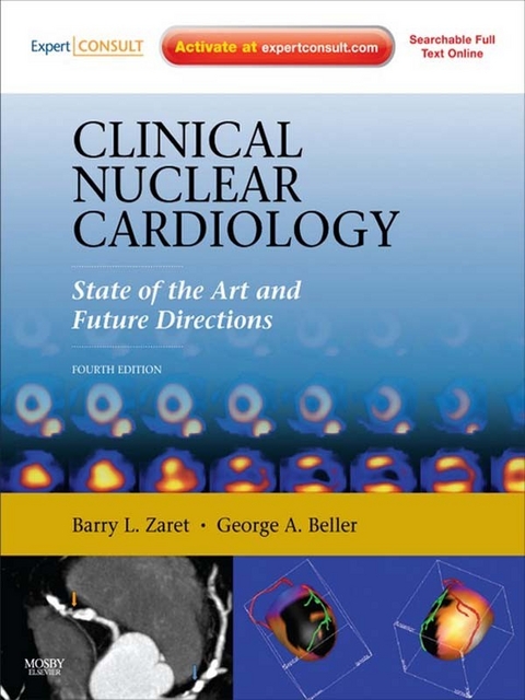 Clinical Nuclear Cardiology: State of the Art and Future Directions -  Barry L. Zaret,  George A. Beller