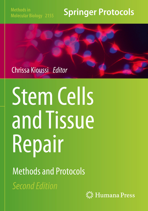 Stem Cells and Tissue Repair - 