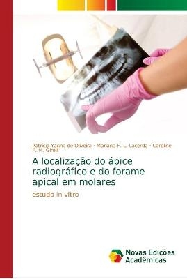 A localização do ápice radiográfico e do forame apical em molares - Patrícia Yanne de Oliveira, Mariane F L Lacerda, Caroline F M Girelli